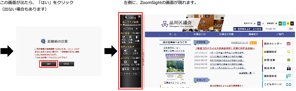 ZoomSight